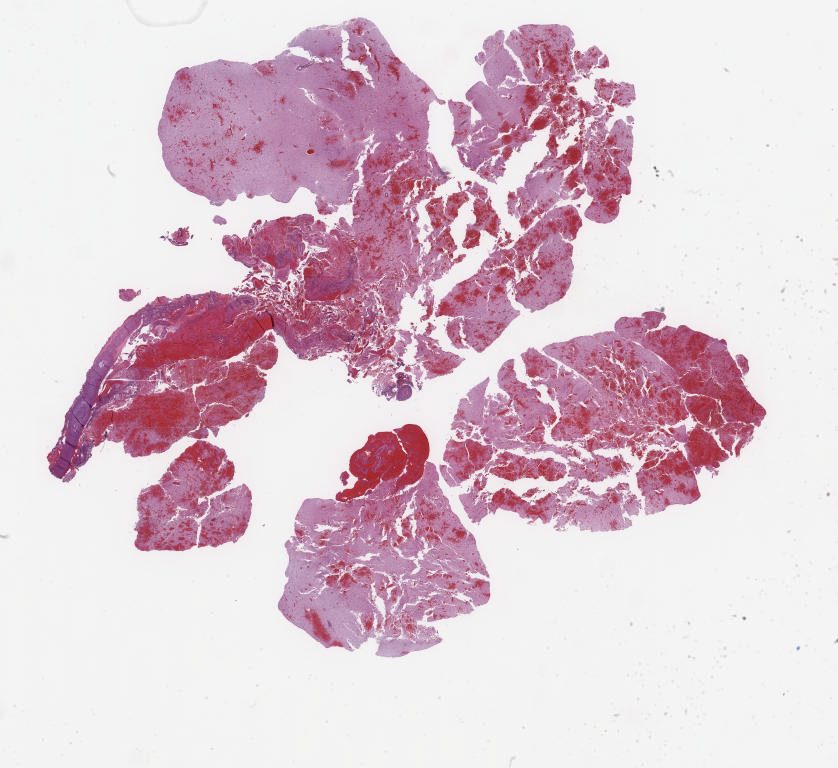 Digital Slide Viewer: neuropathology\Neurodegenerative